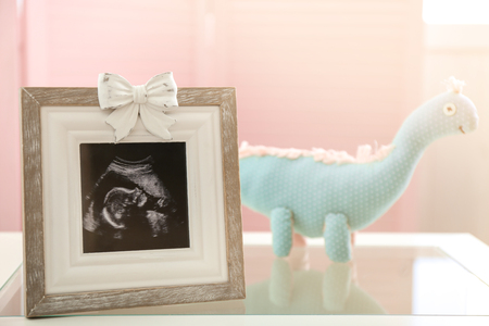 Frame with ultrasound photo and toy on tableの写真素材