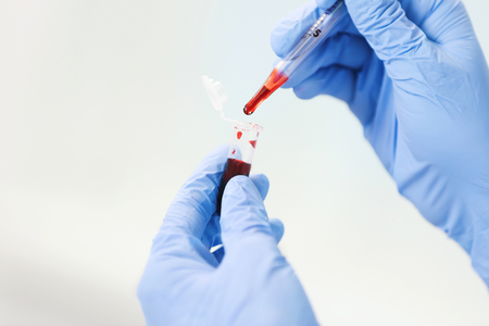 Scientist working with blood sample in laboratoryの写真素材
