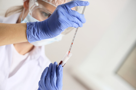 Woman working with blood sample in laboratory