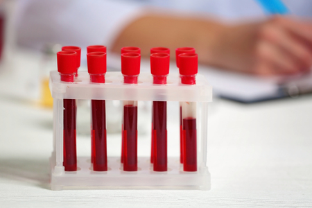 Test tubes with blood samples on table in laboratory, closeupの写真素材