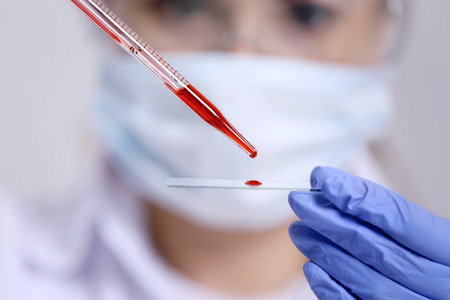 Woman working with blood sample in laboratory, closeupの写真素材