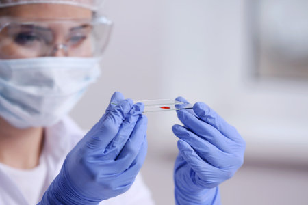 Woman working with blood sample in laboratory, closeupの写真素材