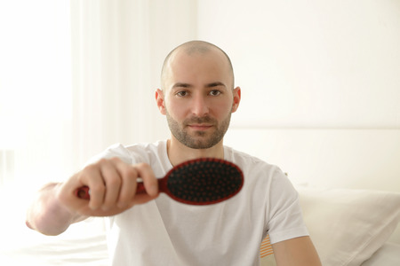 Hair loss concept. Young man with hair comb, closeupの写真素材
