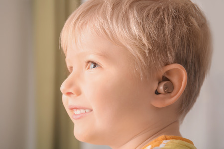 Little boy with hearing aid indoorsの写真素材