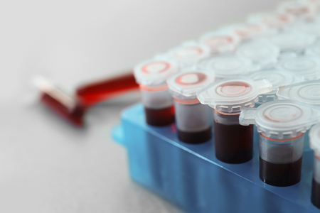 Test tubes with blood samples in holder, closeupの写真素材
