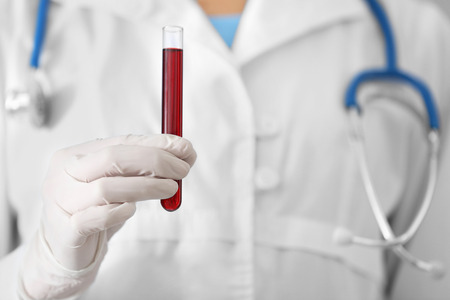 Woman holding test tube with blood sample, closeupの写真素材