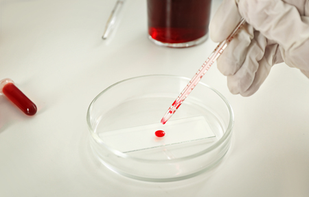 Lab worker dripping blood in petri dish on tableの写真素材