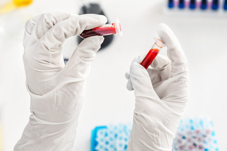 Lab worker holding test tubes with blood, closeup