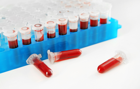 Test tubes with blood on tableの写真素材