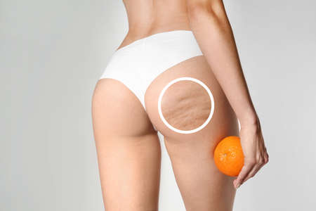Young woman with orange on light background. Problem of celluliteの写真素材