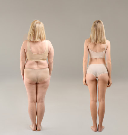 Young woman before and after weight loss on gray backgroundの写真素材