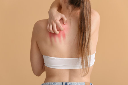Young allergic woman scratching her skin against color backgroundの写真素材