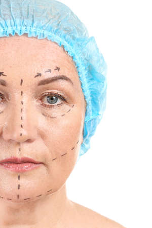 Mature woman with marks on her face against white background, closeup. Concept of plastic surgery