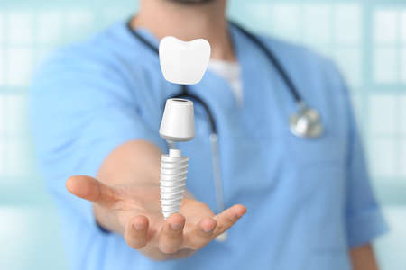 Male dentist with digital model of tooth implant in clinic, closeupの写真素材