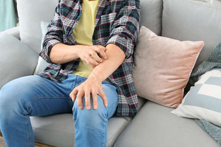 Scratching allergic man at home