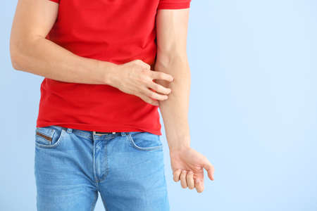 Scratching allergic young man on color backgroundの写真素材