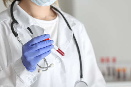 Laboratory assistant holding test tube with blood sample in clinic, closeupの写真素材
