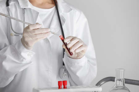 Woman working with blood sample in laboratory, closeupの写真素材