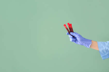 Doctor's hand holding test tubes with blood samples on color backgroundの写真素材