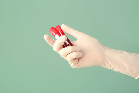 Doctor's hand holding test tubes with blood samples on color backgroundの写真素材