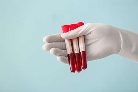 Doctor's hand holding test tubes with blood samples on color background