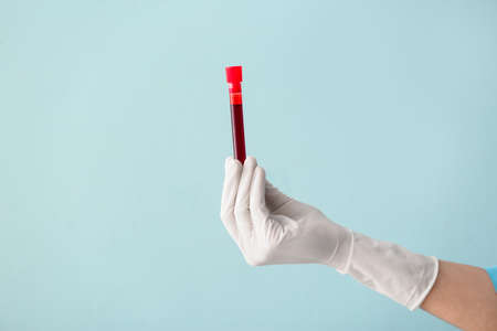 Doctor's hand holding test tube with blood sample on color backgroundの写真素材