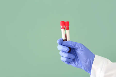 Doctor's hand holding test tubes with blood samples on color backgroundの写真素材