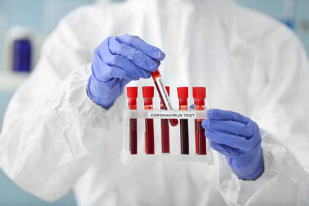 Woman with blood samples in laboratory. Concept of coronavirus epidemic