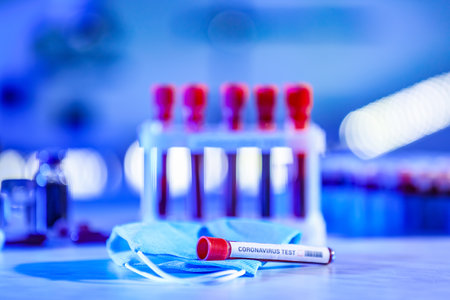 Test tubes with blood samples and mask on table in laboratory. Concept of coronavirus epidemicの写真素材