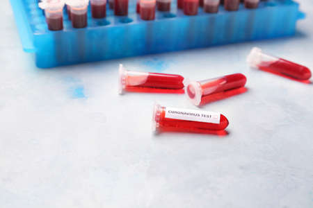 Test tubes with blood samples on table in laboratoryの写真素材