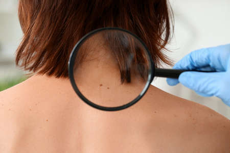 Dermatologist examining patient in clinicの写真素材