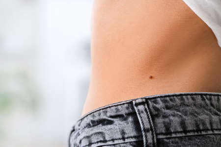 Woman with moles on her skin, closeup