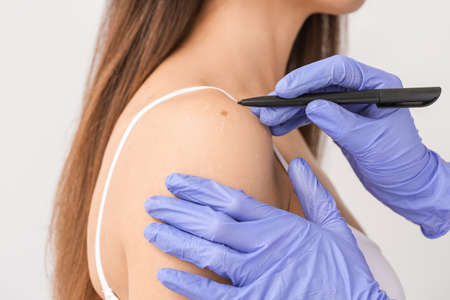 Dermatologist examining patient on light background, closeup