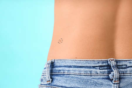 Woman with moles on color background, closeup