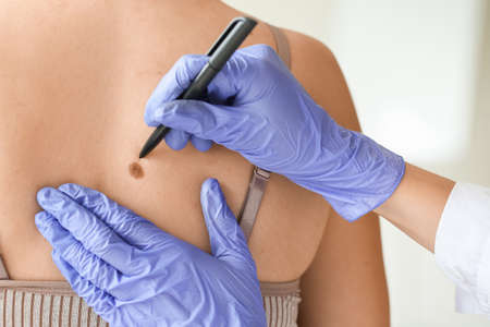 Dermatologist examining patient in clinicの写真素材