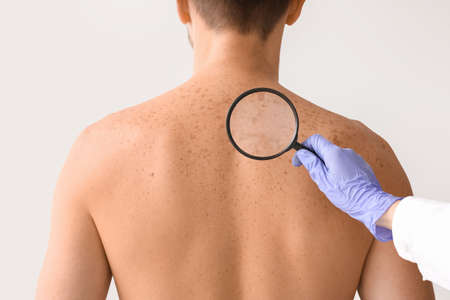 Dermatologist examining patient on light background
