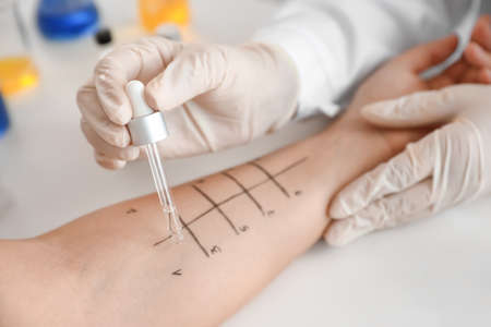 Young woman undergoing procedure of allergen skin tests in clinicの写真素材