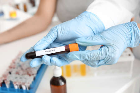 Doctor with allergy test in laboratory