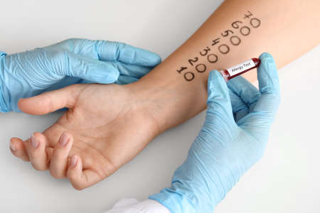 Young woman undergoing procedure of allergen skin tests in clinicの写真素材