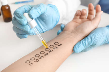 Young woman undergoing procedure of allergen skin tests in clinicの写真素材