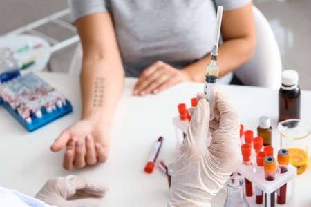 Young woman undergoing procedure of allergen skin tests in clinicの写真素材