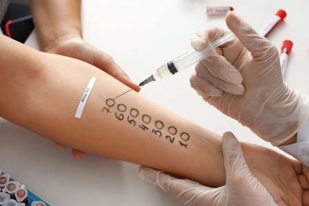 Young woman undergoing procedure of allergen skin tests in clinicの写真素材