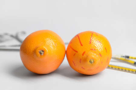 Fresh oranges with surgical tools on light background. Breast augmentation conceptの写真素材
