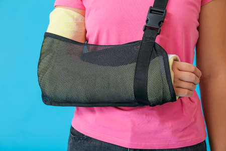 Young woman with broken arm on color background, closeupの写真素材