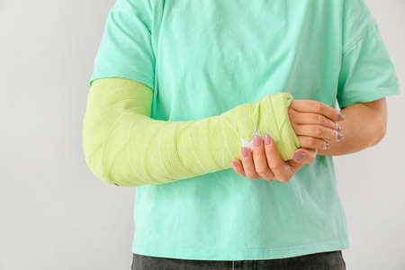 Young woman with broken arm on light backgroundの写真素材