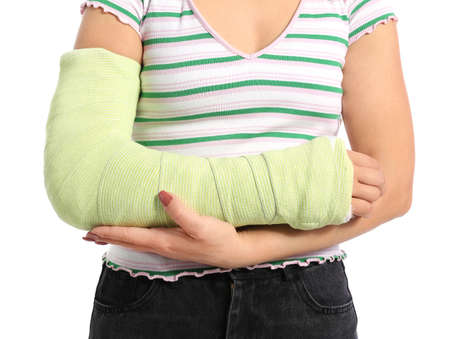 Young woman with broken arm on white background, closeupの写真素材