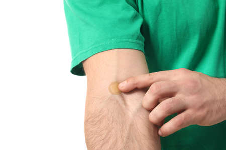 Young man with adhesive patch onto his arm on white background