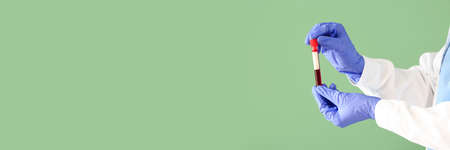Doctor's hands holding test tube with blood sample on green background with space for text