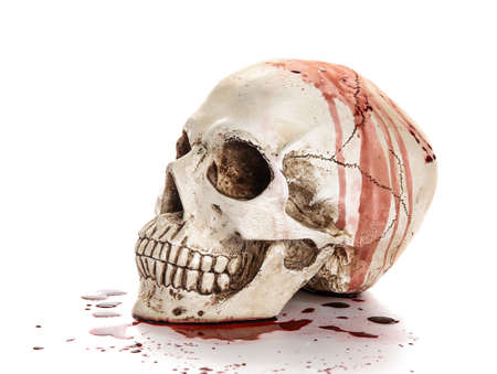 Bloodstained human skull on white backgroundの写真素材