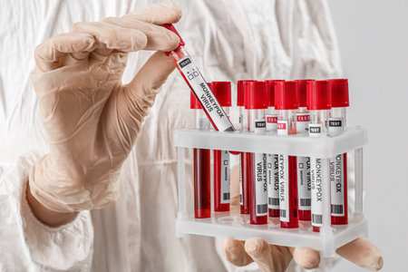 Scientist with samples of monkeypox virus on light background, closeup